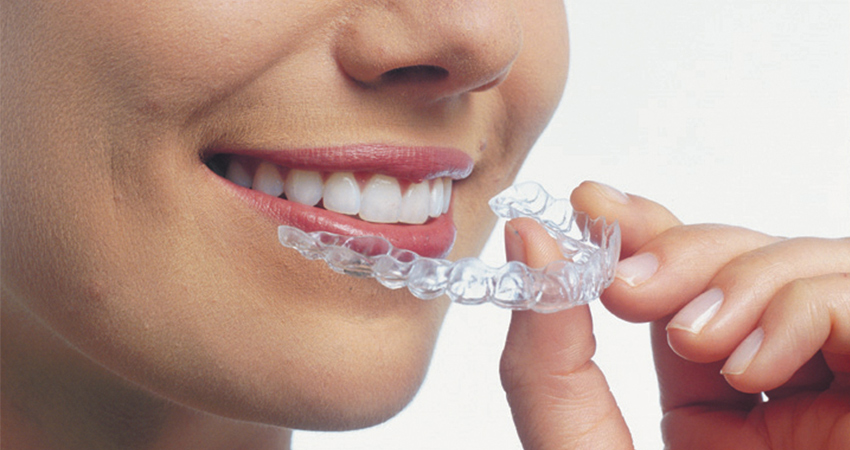 a close up of a woman holding an Invisalign aligner in front of her smile